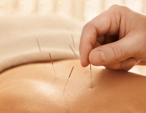 ACUPUNCTURE FOR WOMEN